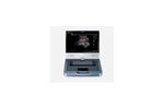 EDAN Acclarix - Model AX8 - Diagnostic Ultrasound System