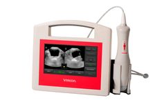 VitaScan - Model PD V2 - Portable Ultrasound Bladder Scanner