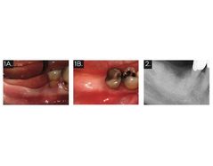 Dynamic Surgical Guidance to Facilitate Dental Implant Placement