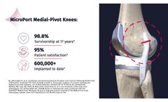 Evolution Kinematic Alignment Patient Education Animation- Video
