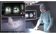 7D Surgical System – Spinal Workflow Demonstration - Video