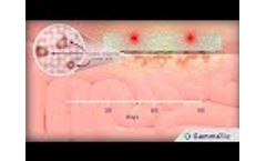 GammaTile Therapy: How It Works - Video