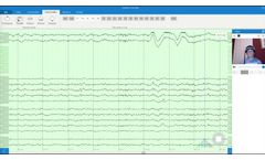 Zeto software demo for reading EEG - Video