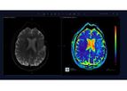 Arterys - Version Neuro AI - Neuro-Radiology Software