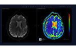 Arterys - Version Neuro AI - Neuro-Radiology Software