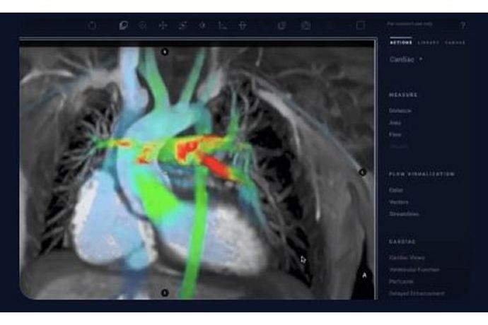 Arterys- - Version Cardio AI - Assisted Cardiac MRI Software