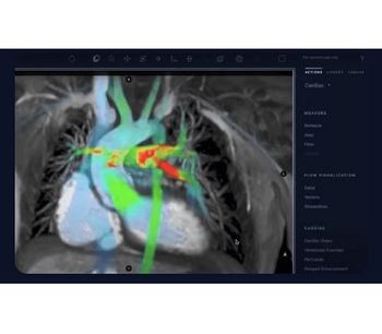 Arterys- - Version Cardio AI - Assisted Cardiac MRI Software