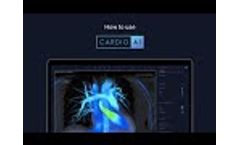 Learn to use Cardio AI to analyse Cardiac MRI studies. - Video