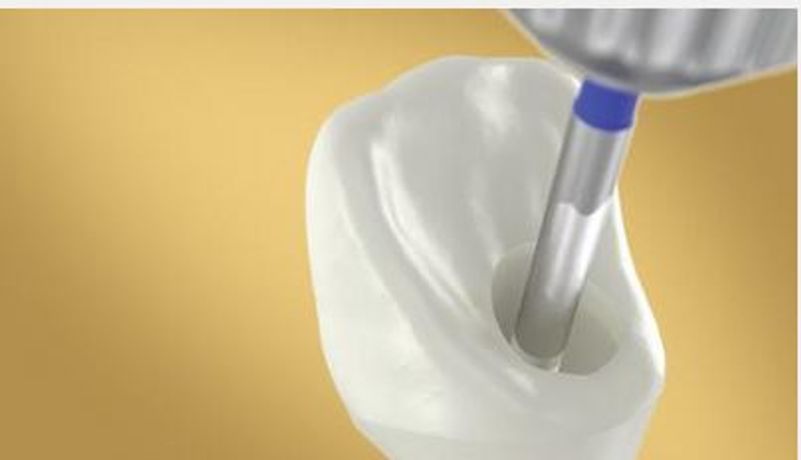 Nobel-Biocare - Model N1 - Angulated Dental Screw Channel