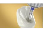 Nobel-Biocare - Model N1 - Angulated Dental Screw Channel