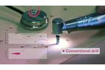 Nobel Biocare N1 | Conventional drill compared to OsseoShaper - Video