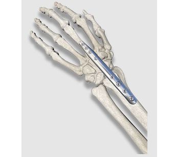 OrthoPediatrics PediFrag - Wrist Fusion System