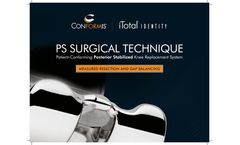 iTotal Identity - Patient-Conforming Posterior StabilizedKnee Replacement System - Brochure