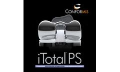 iTotal - Model PS - Total Knee Replacement System - Brochure