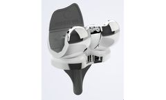 iTotal - Model PS - Total Knee Replacement System