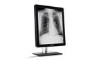 Coronis - Model 5MP LED (MDCG-5221) - Mammography Display