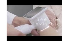 Barco Demetra: a smarter way of doing skin exams - Video