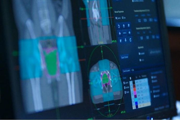 Accuray Alliance Services for Radiotherapy Innovation