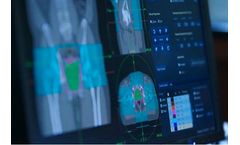 Accuray Alliance Services for Radiotherapy Innovation