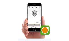 Dexcom - Version G5 - Mobile App