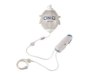 Avanos - Model ON-Q - Pump with Ondemand Bolus Button
