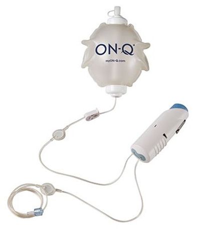 Avanos - Model ON-Q - Pump With Ondemand Bolus Button