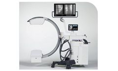 Primax Cyberbloc - Model FP-S - Compact Mobile Fluoroscopy System
