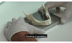 myplant GmbH: Positioning and aligning of angulated standard abutments - Video