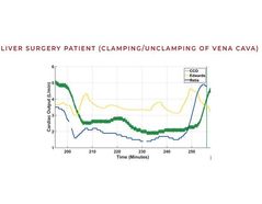 Accurate CO Tracking During High-Risk Surgery - Case Study