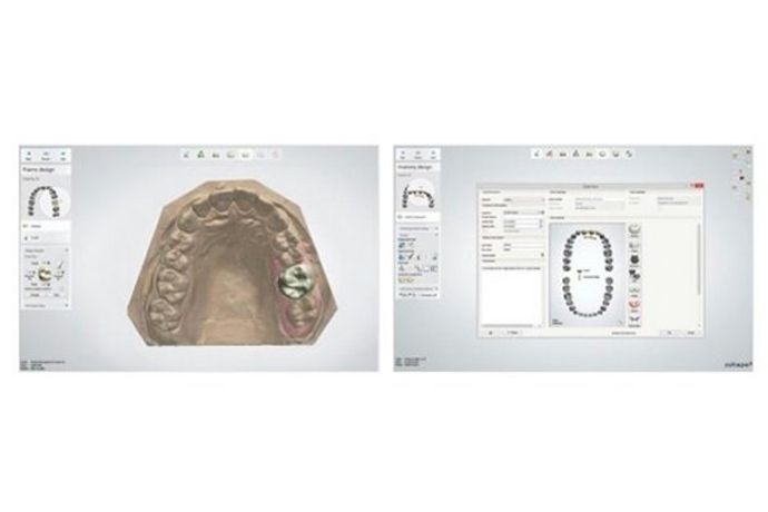 3Shape Dental System™ CAD Software