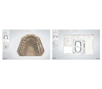 3Shape Dental System™ CAD Software