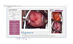 Medgyn Image and Data Management Software