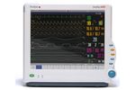 Penlon AnaVue - Model 4000 - Patient Monitor