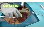 bkActiv: Active Imaging for General Surgery and HPB - Video