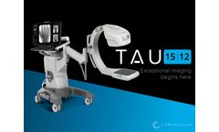 Orthoscan TAU 1512 Mini C-Arm Imaging System Brochure