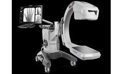 Orthoscan - Model TAU 2020 - Mini C-Arm Imaging System