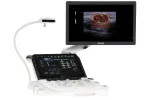 MyLab - Model X90  - Ultrasound Platform for Outstanding Image Quality