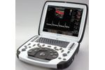 uSmart - Model 3300 NexGen - Portable Ultrasound Scanner
