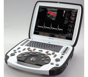uSmart - Model 3300 NexGen - Portable Ultrasound Scanner