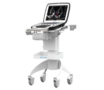 uSmart - Model 3300 NexGen - Ultrasound System