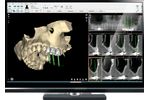 NemoScan - Solution for Diagnosis and Planning of Implantology Treatments