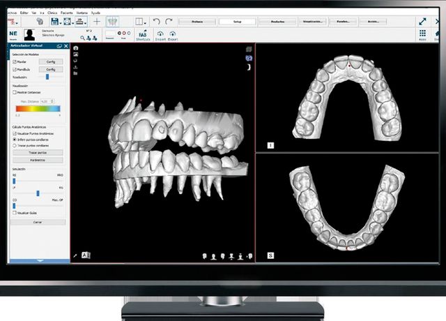 NemoCast - Solution for Diagnosis and Digital Planning of Orthodontic Models