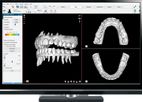 NemoCast - Solution for Diagnosis and Digital Planning of Orthodontic Models