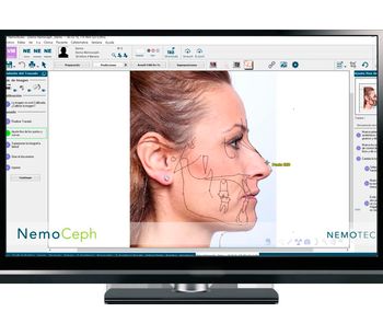 Nemoceph Cephalometric, VTO And STO 2D Virtual Analysis Software