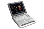 Model C6VET - Hand-carried Color Doppler Diagnostic Ultrasound System for Veterinary