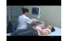 Landwind Medical Color Doppler Ultrasound Scanner Demonstration - Video