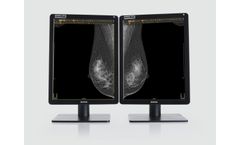 Æstimax - Mammography Reporting Software