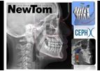 Newtom - CephX - Artificial Intellingence Cephalometry