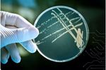 DNA Analyzer for Legionella Test - Medical / Health Care - Medical Monitoring