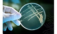 DNA Analyzer for Legionella Test